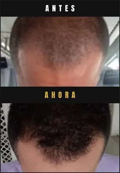 Caso real Barba Larga