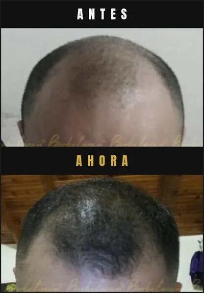 Caso real Barba Larga