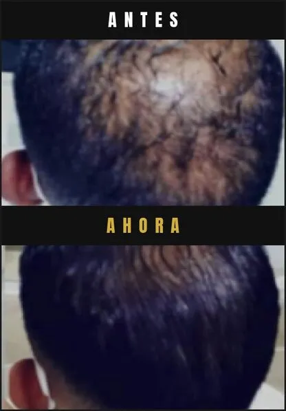 Caso real Barba Larga