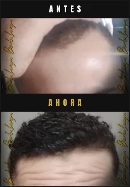 Caso real Barba Larga