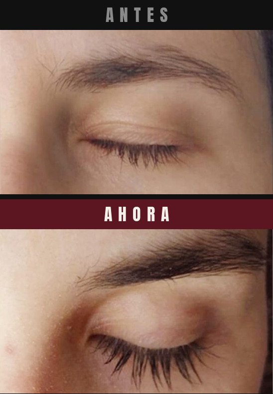 Caso real cejas y pestanas Barba Larga