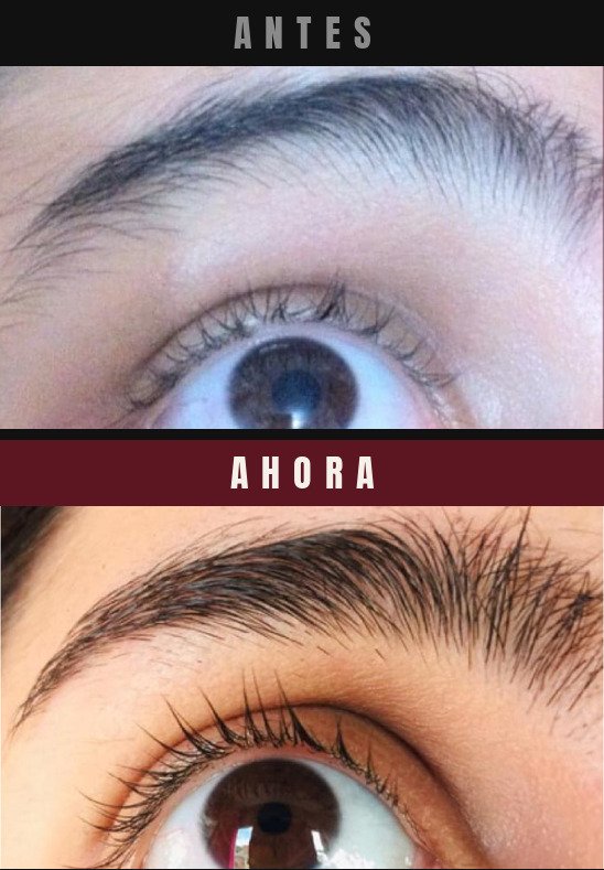 Caso real cejas y pestanas Barba Larga