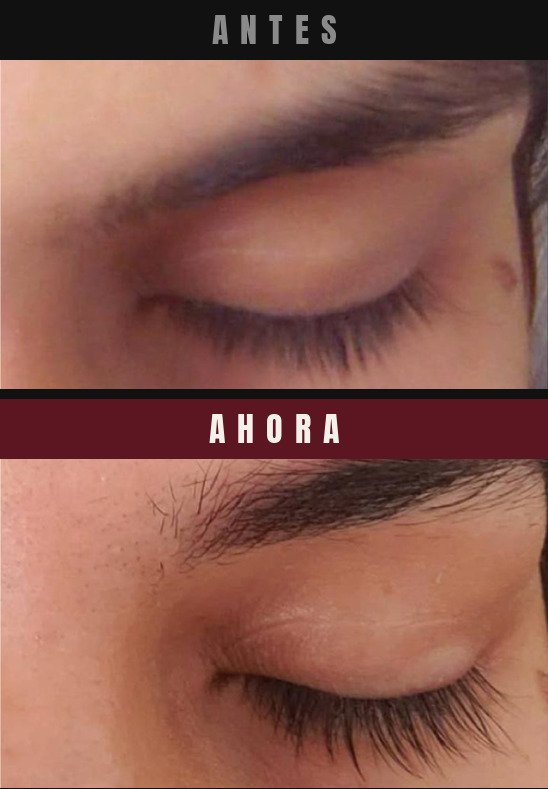 Caso real cejas y pestanas Barba Larga