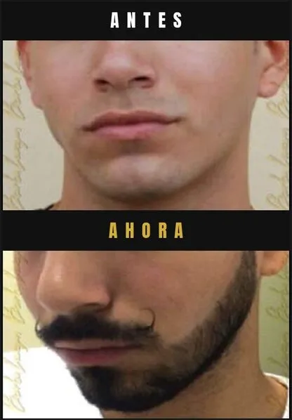 Caso real Barba Larga