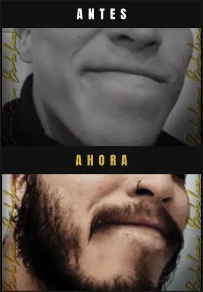 Caso real Barba Larga