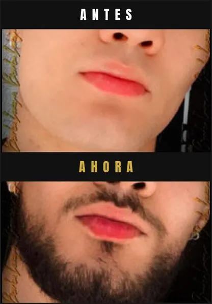 Caso real Barba Larga