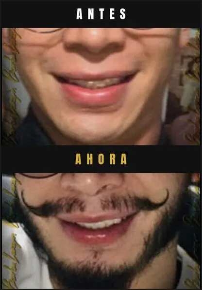 Caso real Barba Larga