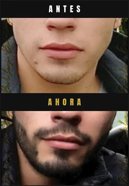 Caso real Barba Larga
