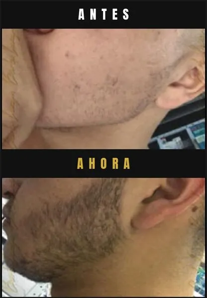 Caso real Barba Larga