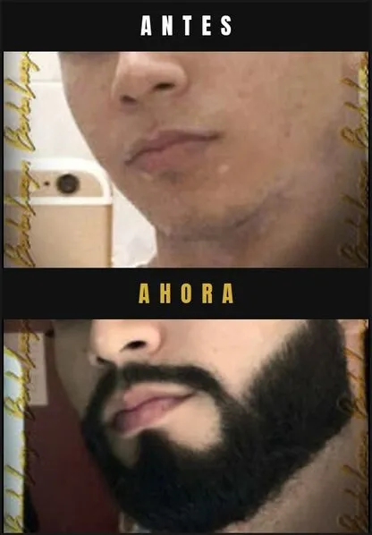 Caso real Barba Larga