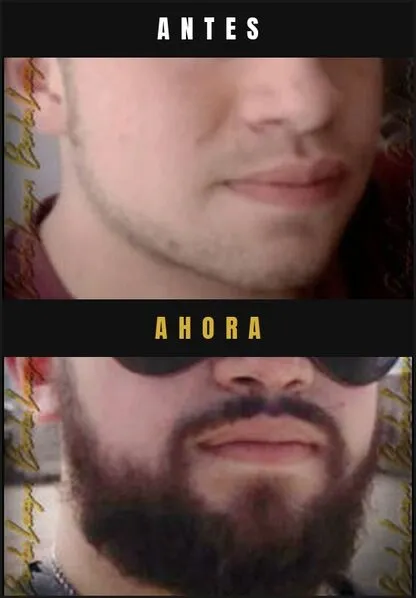 Caso real Barba Larga