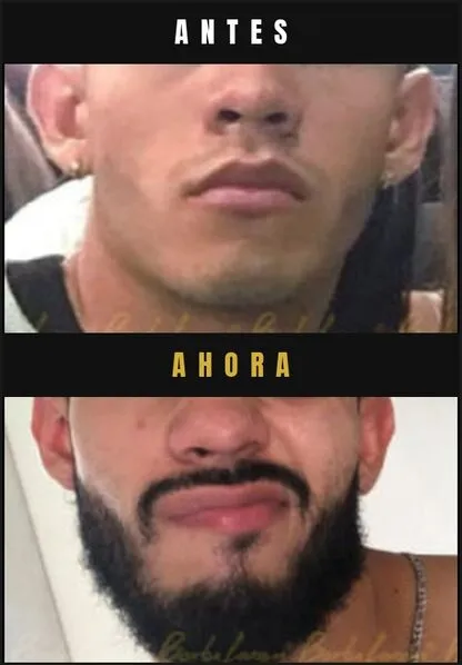 Caso real Barba Larga