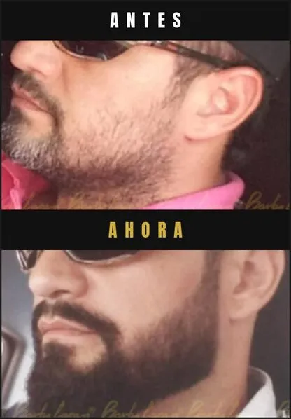 Caso real Barba Larga