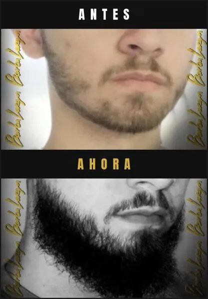 Caso real Barba Larga