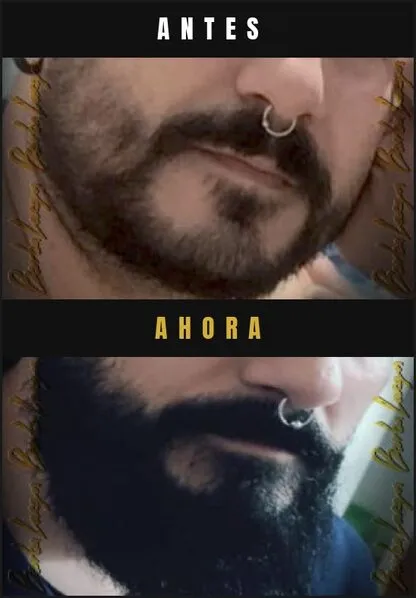 Caso real Barba Larga