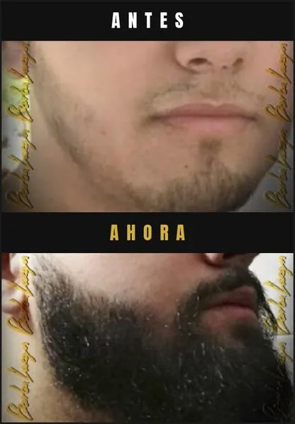Caso real Barba Larga