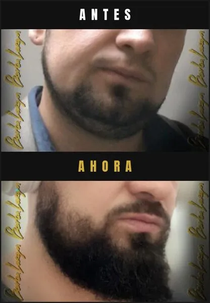 Caso real Barba Larga