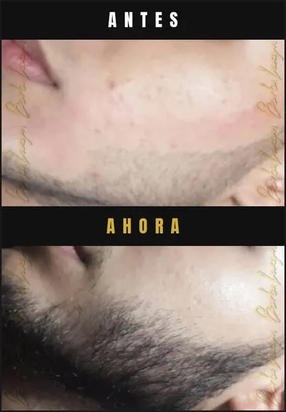 Caso real Barba Larga