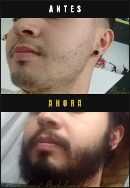 Caso real Barba Larga