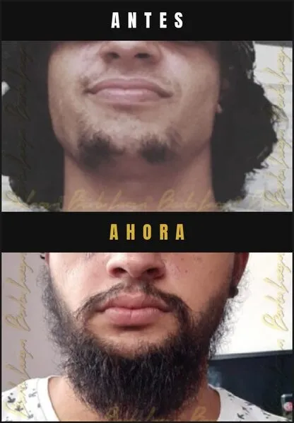 Caso real Barba Larga