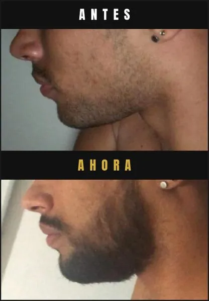 Caso real Barba Larga