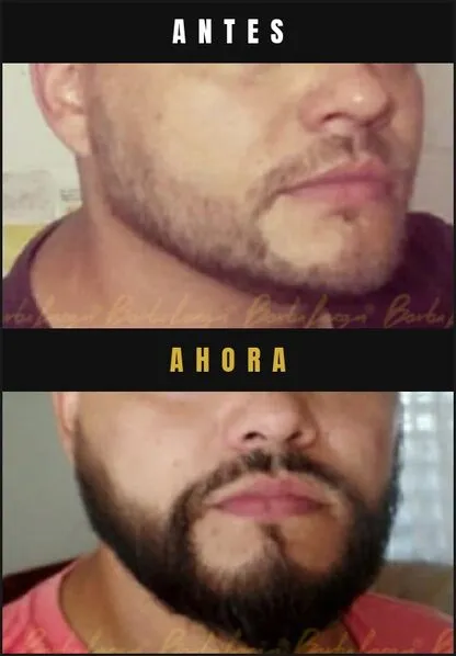 Caso real Barba Larga
